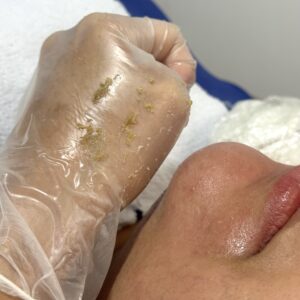 Limpeza de pele - Protocolo Completo