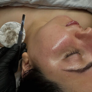 DERMAPLANING BEAUTY - PEELING FISICO