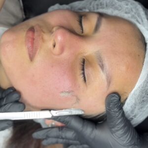 COMBO FACIAL: LIMPEZA DE PELE + DERMAPLANING